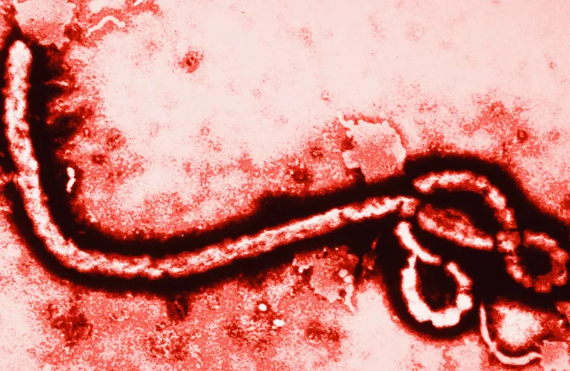 The Ebola virus